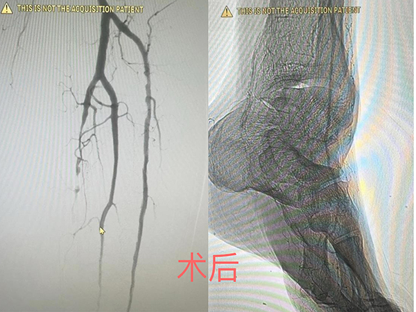 术后.jpg