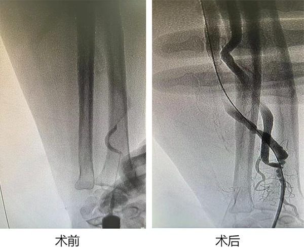 术前.png