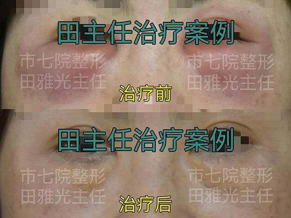 6f5258799ae86b0e71125d5b9615772.jpg